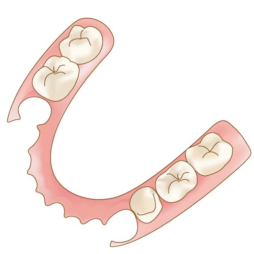 ノンクラスプの部分入れ歯