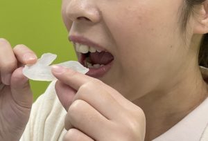鳥取市　歯医者　マウスピース　スプリント療法　顎関節症　