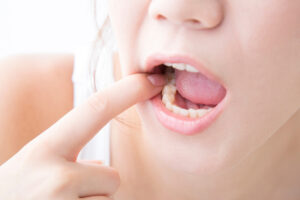 奥歯を確認するために口を大きく開ける女性