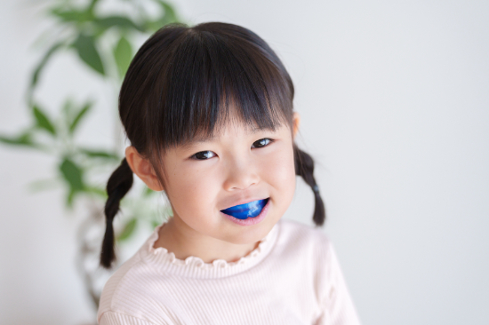 受け口の治療でプレオルソを装着した女の子