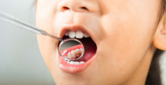 虫歯予防に定期歯科検診をする子ども