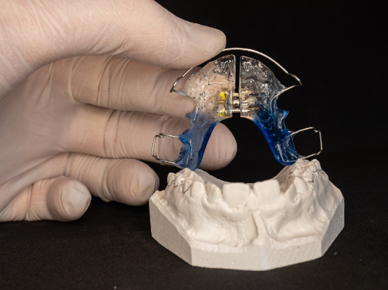 床矯正の型取りと装置の作製の様子