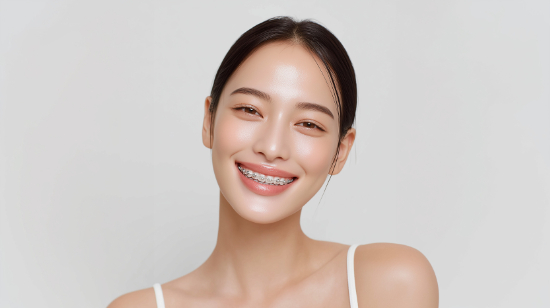 ワイヤー矯正で歯列を整える女性