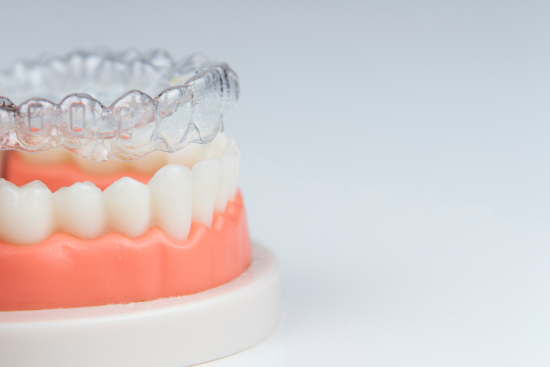 インビザラインのアライナーとの間に隙間があるイメージ