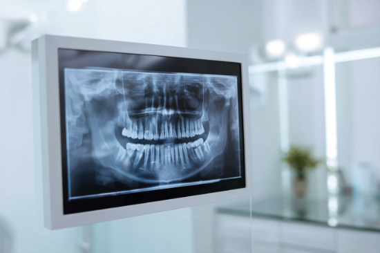 レントゲン検査の様子