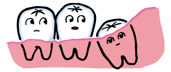 親知らずのイメージ